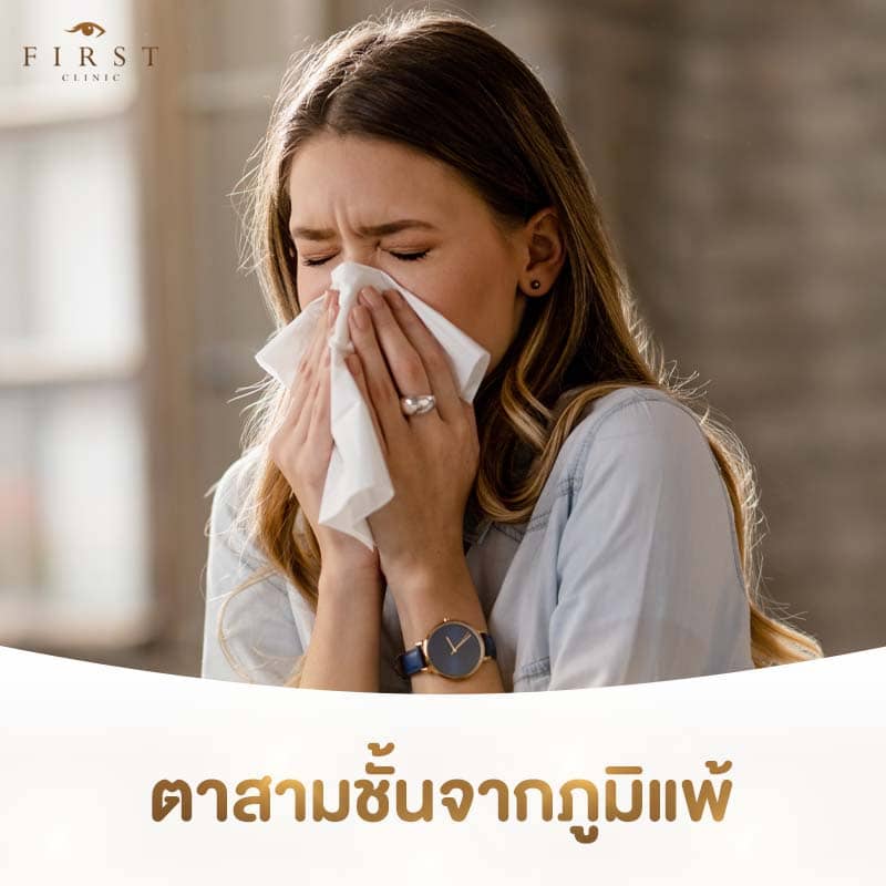 ภูมิแพ้