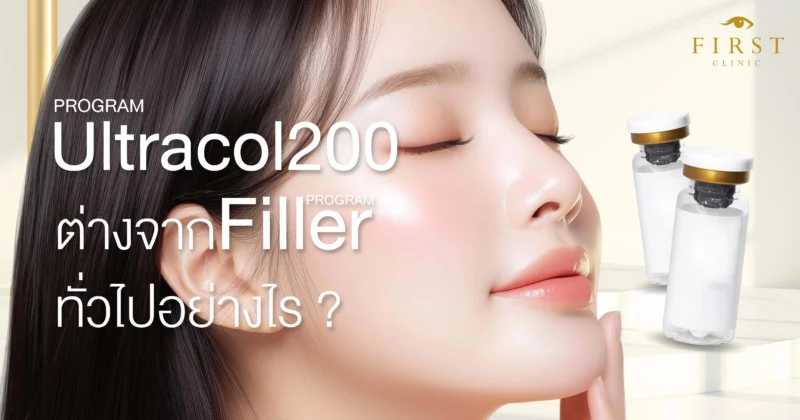 Ultracolต่างจากฟิลเลอร์ยังไง