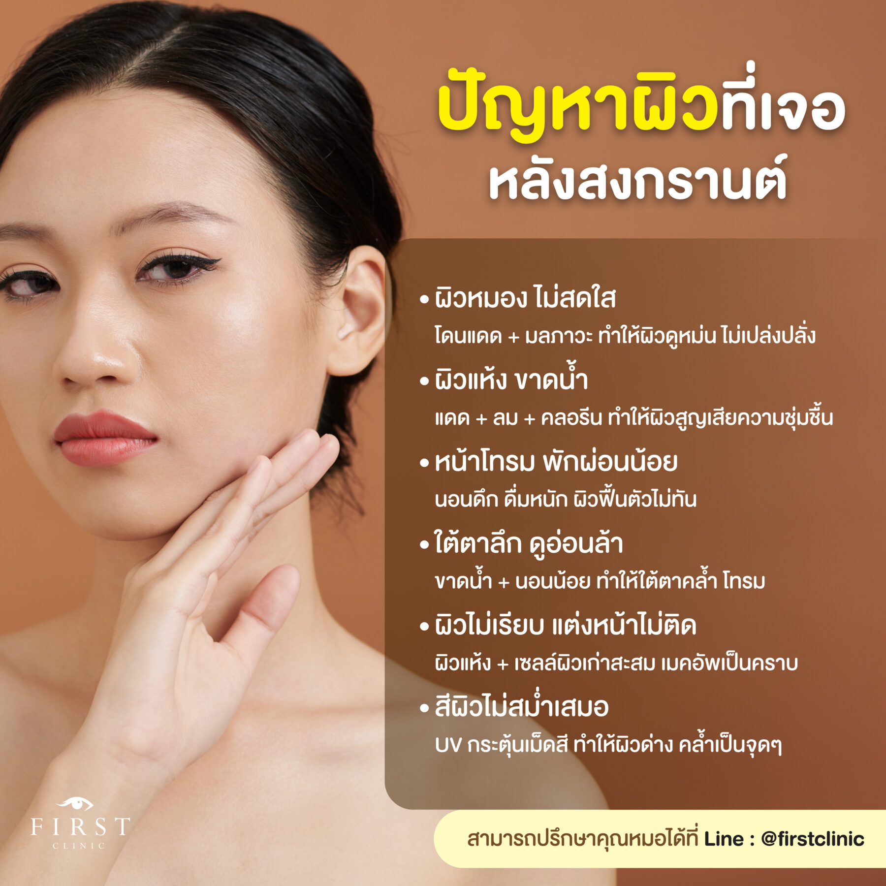 กู้ผิวหลังสงกรานต์